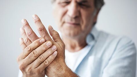 Stock de stockage et douleur dans l'arthrose des mains