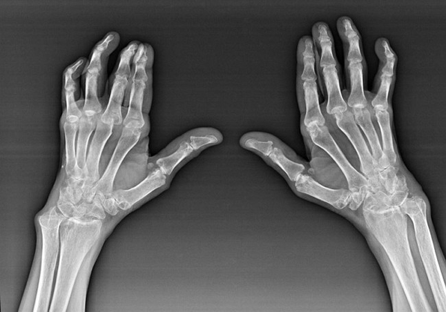 Diagnostics des connexions des doigts