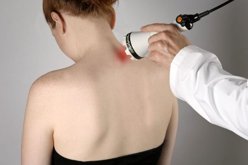 Traitement au laser de l'ostéochondrose cervicale chez la femme